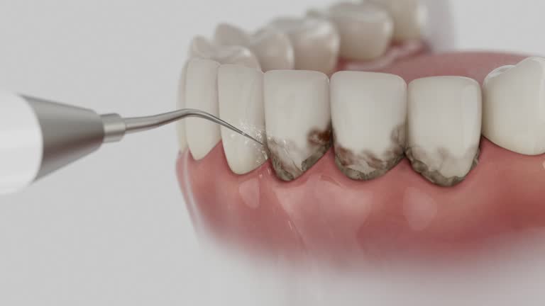Trusted Wisdom Tooth Removal service in Orion, IL - Dentist Open Now